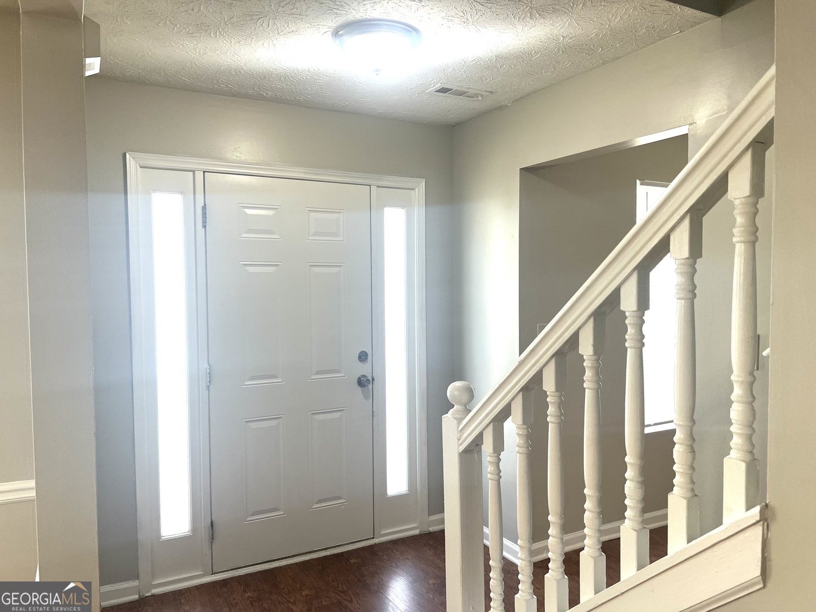 755 Kilkenny Circle Lithonia - 5