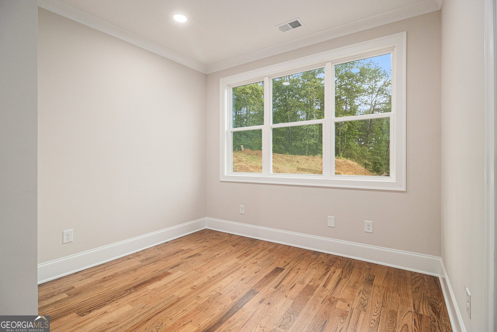 52 Lake Overlook Drive White - 33