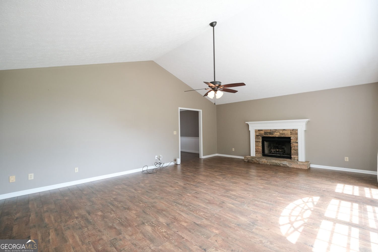 151 Springwater Trace Woodstock - 1