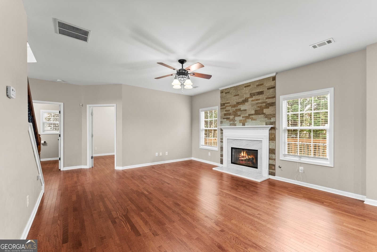 2640 Blackstock Drive Cumming - 7