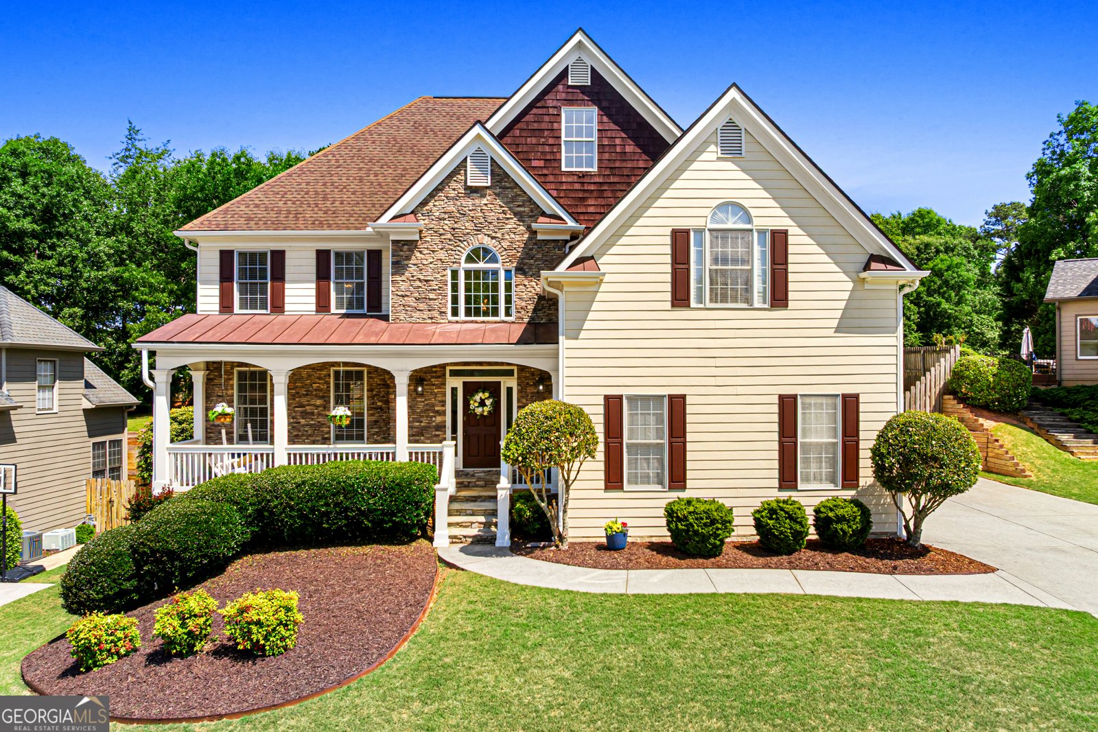 398 Vista Lake Drive Suwanee - Photo 1