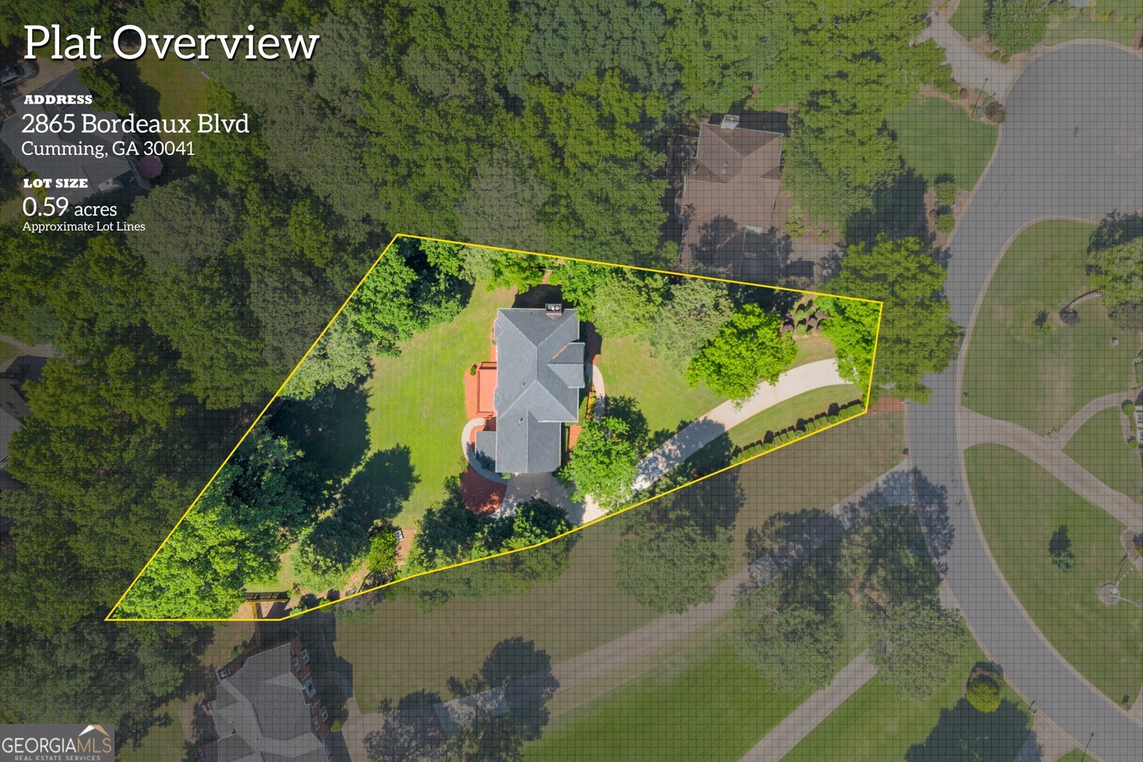 2865 Bordeaux Boulevard Cumming - Photo 72