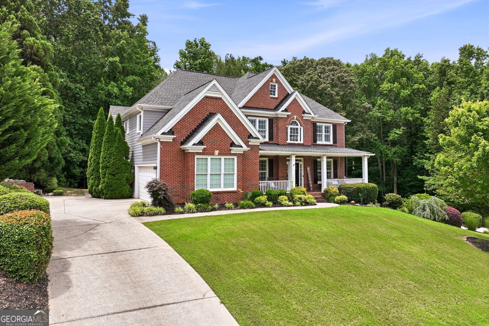 411 Hunting Hills Drive Braselton - Photo 8