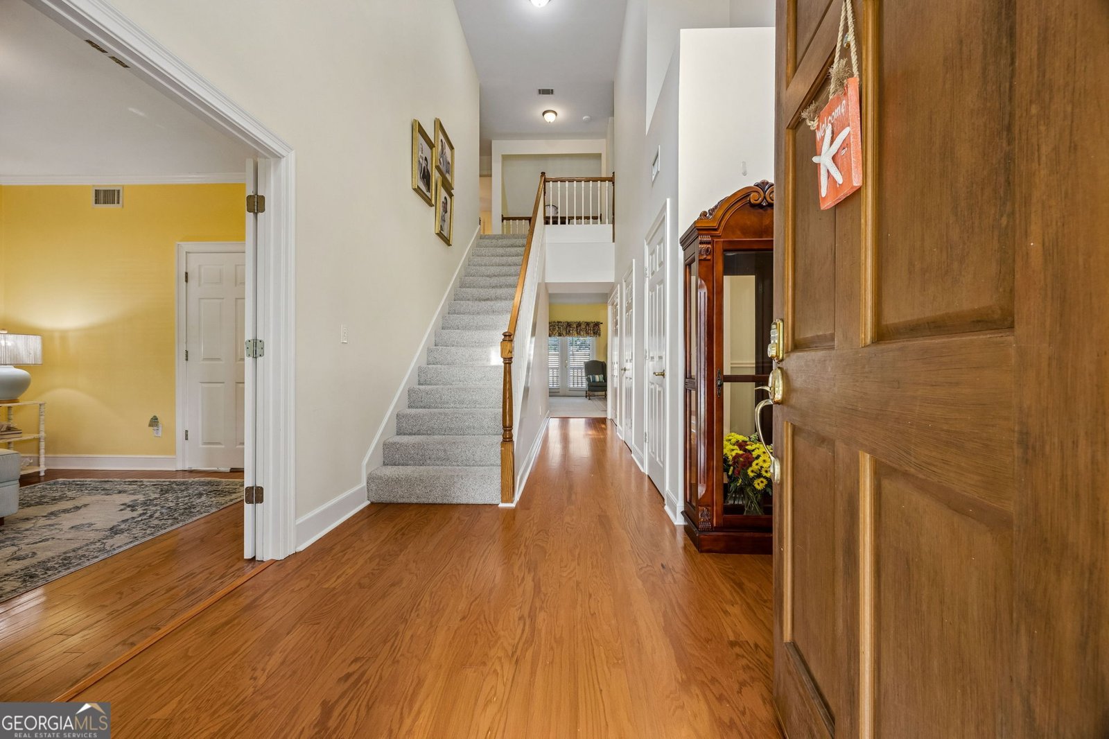 155 Shadow Wood Bend St. Simons - Photo 7